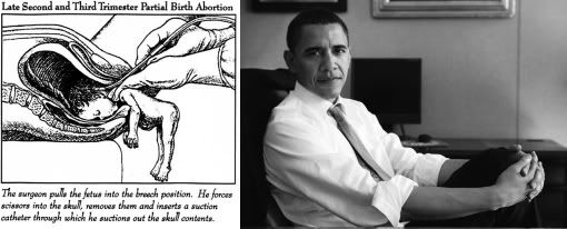 Partial Birth Abortion Obama